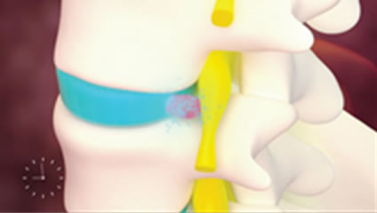 Gallery Item 1